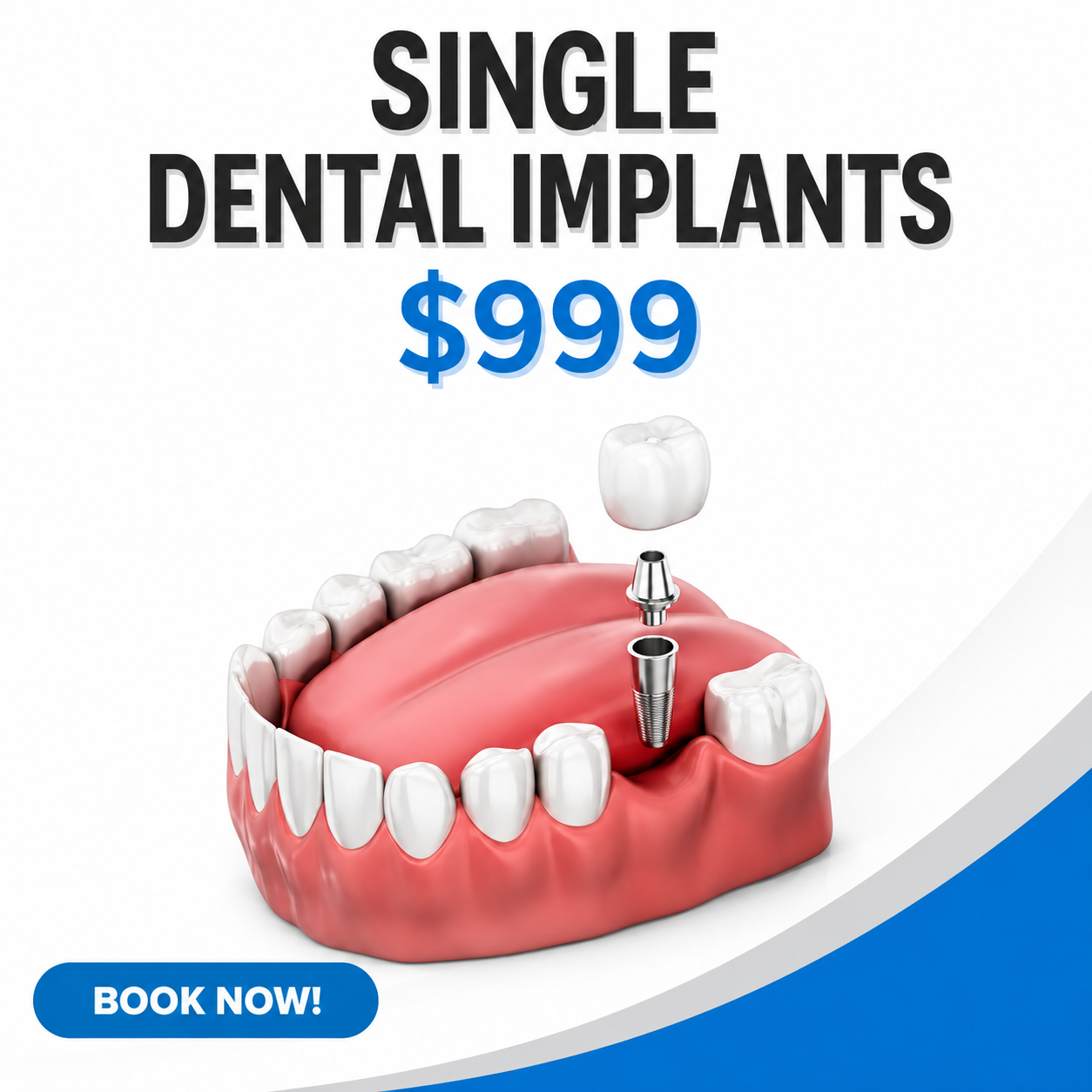Dental practice ad creative produced by Growbi, variation 15